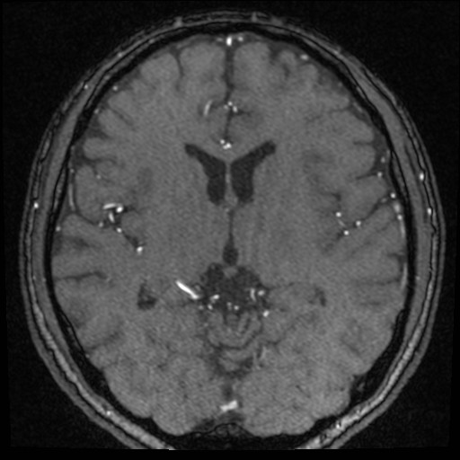 Click on the Serie image to view the images of VILLANUEVA, WILLIAM A.